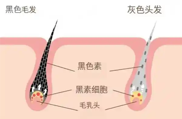 医生揭秘：头发白了还能变黑吗？惊人答案让人大开眼界！