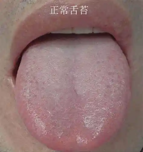 《刷牙时的隐形雷区，99%的人竟都忽略了它！口臭元凶曝光》